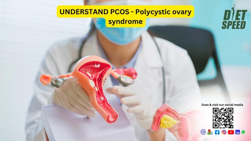 PCOS